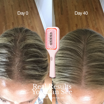 Red Light Hair Revival Brush